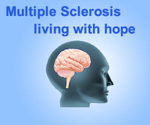 Multiple-Sclerosis-b.jpg